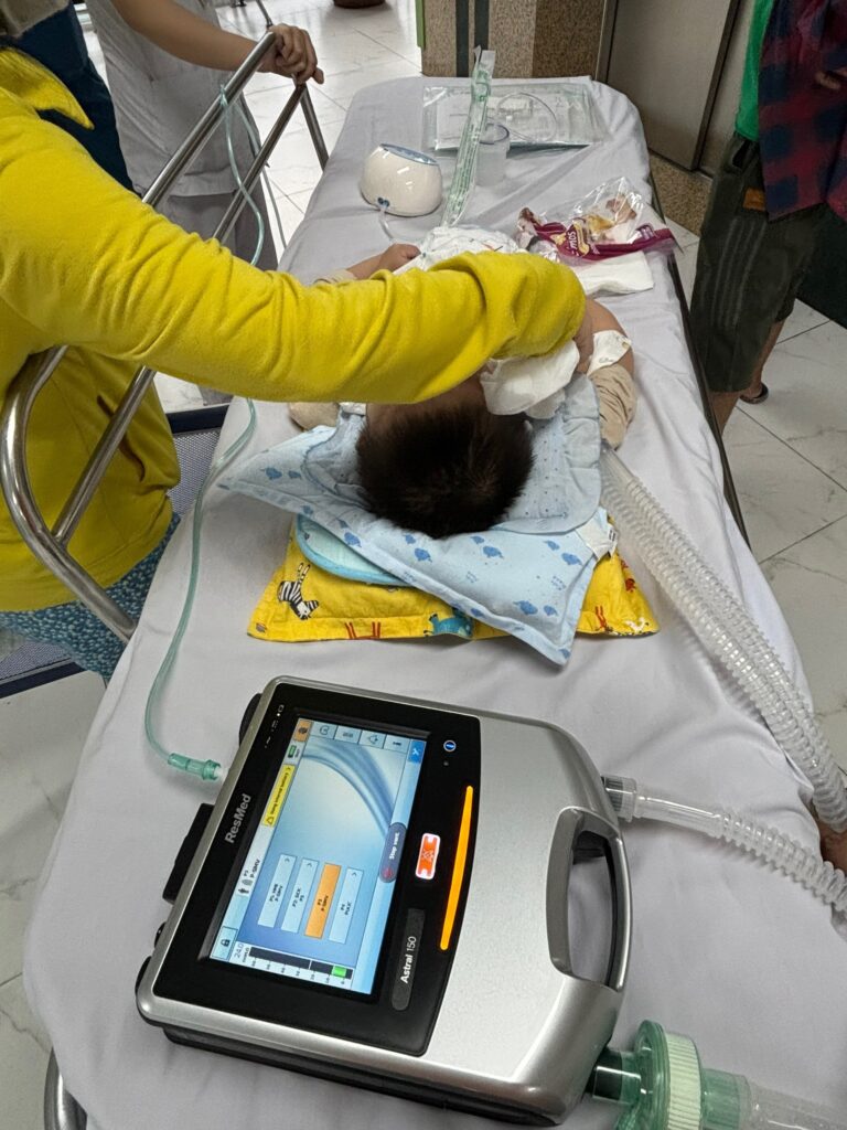 thuê máy thở Resmed Astral 150