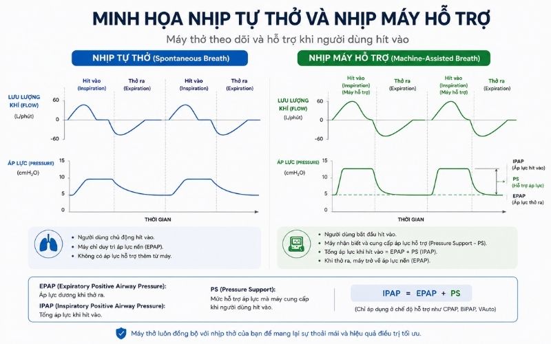 AirCurve 10 VAuto hay Lumis 150: Máy nào phù hợp hơn? Minh hoa nhip tu tho va nhip may ho tro