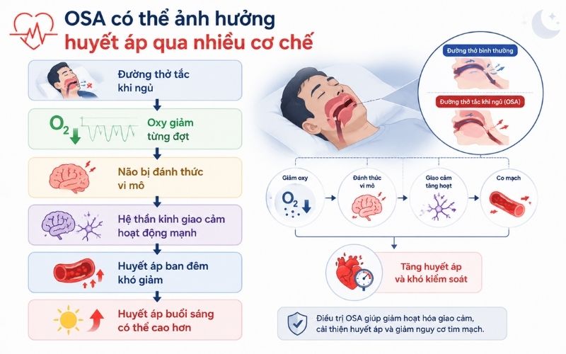 Ngung tho khi ngu va tang huyet ap lien quan the nao